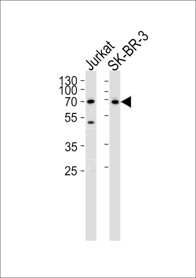 CD46 Antibody in Western Blot (WB)