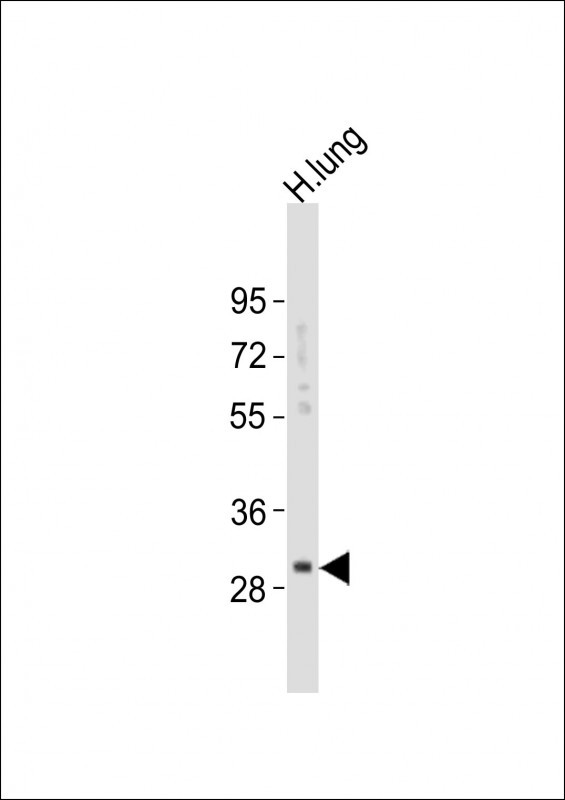 Kallikrein 6 Antibody in Western Blot (WB)