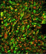 PTP4A2 Antibody in Immunohistochemistry (Paraffin) (IHC (P))