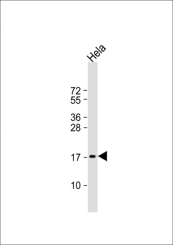 PTP4A2 Antibody in Western Blot (WB)