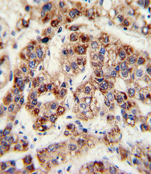 OTC Antibody in Immunohistochemistry (Paraffin) (IHC (P))