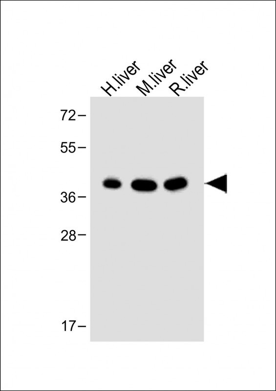 OTC Antibody in Western Blot (WB)