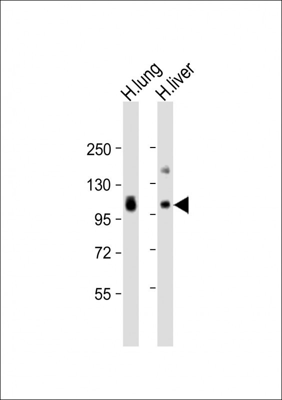 AOC3 Antibody in Western Blot (WB)