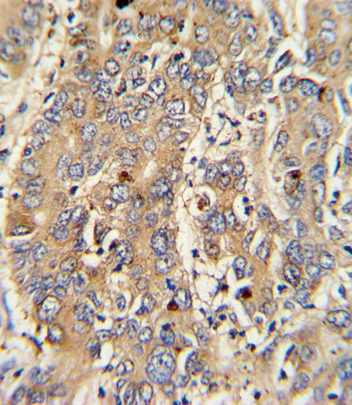 PIGR Antibody in Immunohistochemistry (Paraffin) (IHC (P))