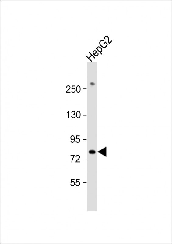 PIGR Antibody in Western Blot (WB)