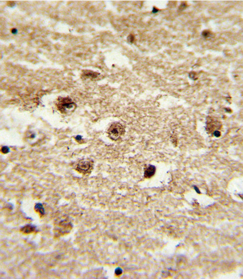 IGFBP2 Antibody in Immunohistochemistry (Paraffin) (IHC (P))