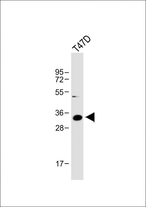 IGFBP2 Antibody in Western Blot (WB)