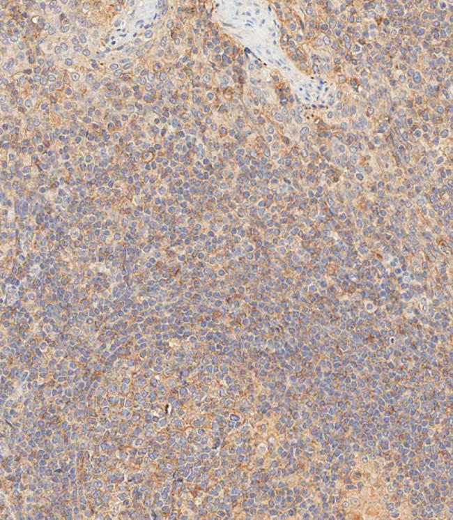 HLA-B Antibody in Immunohistochemistry (Paraffin) (IHC (P))