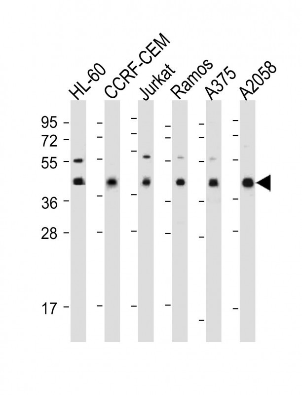 HLA-B Antibody in Western Blot (WB)