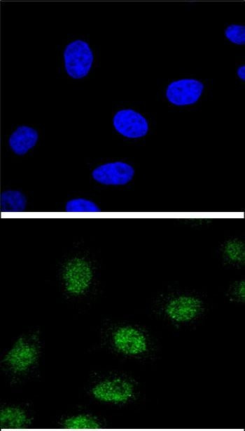 ESRRA Antibody in Immunocytochemistry (ICC/IF)