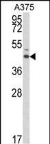 ESRRA Antibody in Western Blot (WB)