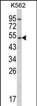 CYP2E1 Antibody in Western Blot (WB)