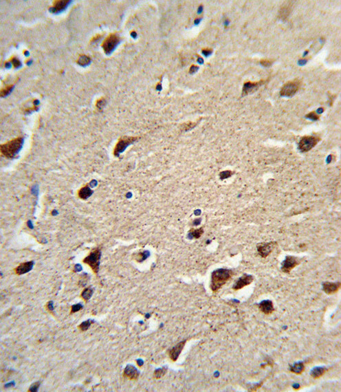 OAT Antibody in Immunohistochemistry (Paraffin) (IHC (P))