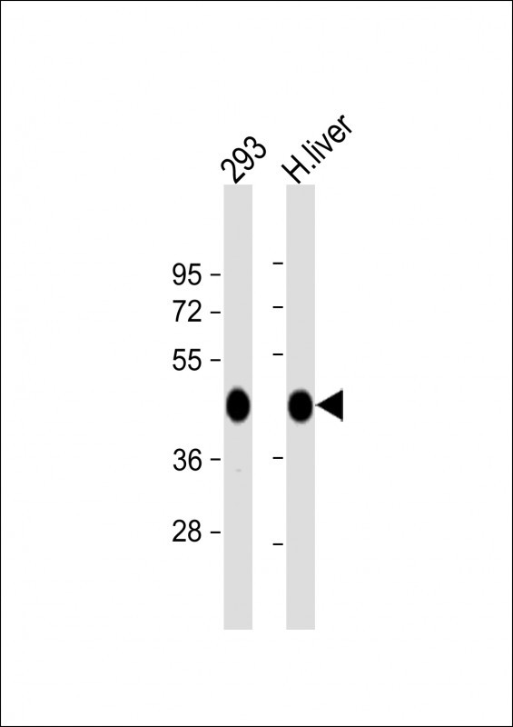 OAT Antibody in Western Blot (WB)