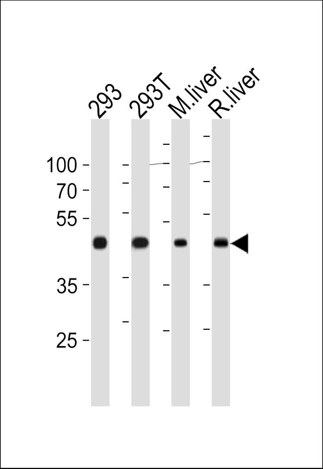 OAT Antibody in Western Blot (WB)