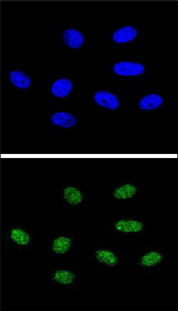 PIN1 Antibody in Immunocytochemistry (ICC/IF)