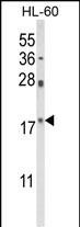 PIN1 Antibody in Western Blot (WB)