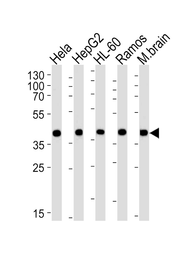 GOT2 Antibody in Western Blot (WB)