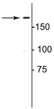 Procollagen I N-Peptide Antibody in Western Blot (WB)