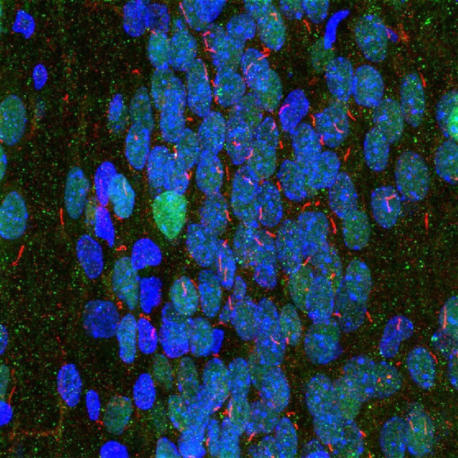 Adenylate Cyclase 3 Antibody in Immunohistochemistry (IHC)