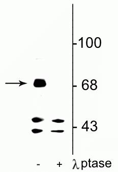 Phospho-FMRP (Ser499) Antibody in Western Blot (WB)