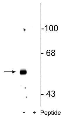 Phospho-GABRB3 (Ser408, Ser409) Antibody in Western Blot (WB)