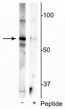 Phospho-MECP2 (Ser421) Antibody in Western Blot (WB)