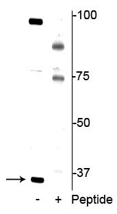 Phospho-DDIT4 (Thr23, Thr25) Antibody in Western Blot (WB)