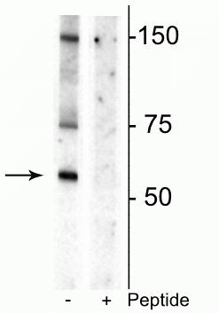 Phospho-Dopamine Transporter (Thr53) Antibody in Western Blot (WB)