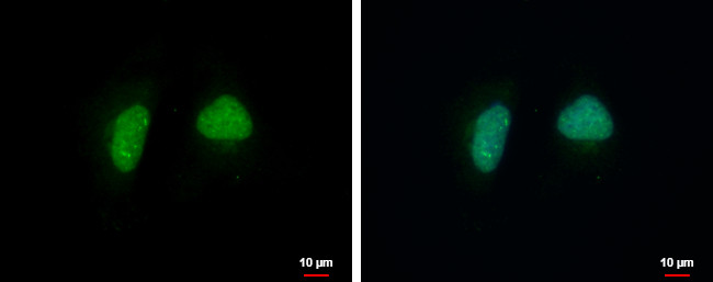 ADPRHL1 Antibody in Immunocytochemistry (ICC/IF)