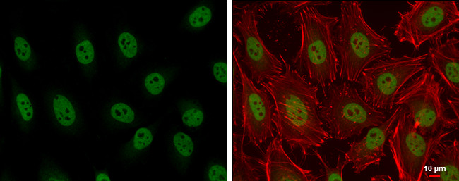 ARID2 Antibody in Immunocytochemistry (ICC/IF)