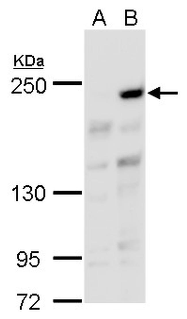 ARID2 Antibody in Western Blot (WB)