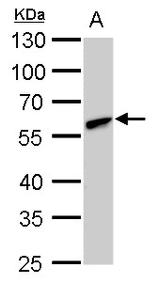 CLN3 Antibody in Western Blot (WB)