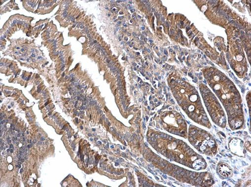 CNTROB Antibody in Immunohistochemistry (Paraffin) (IHC (P))