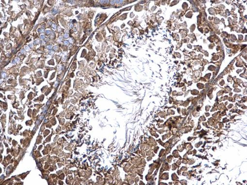 CNTROB Antibody in Immunohistochemistry (Paraffin) (IHC (P))