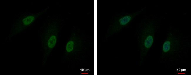 DBF4B Antibody in Immunocytochemistry (ICC/IF)