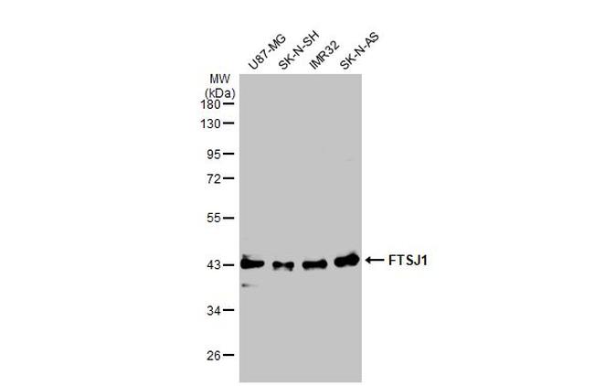 FTSJ1 Antibody in Western Blot (WB)