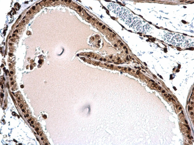 Histone H1.3 Antibody in Immunohistochemistry (Paraffin) (IHC (P))