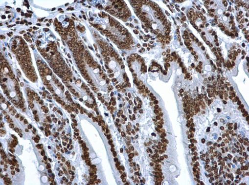 Histone H2A Antibody in Immunohistochemistry (Paraffin) (IHC (P))