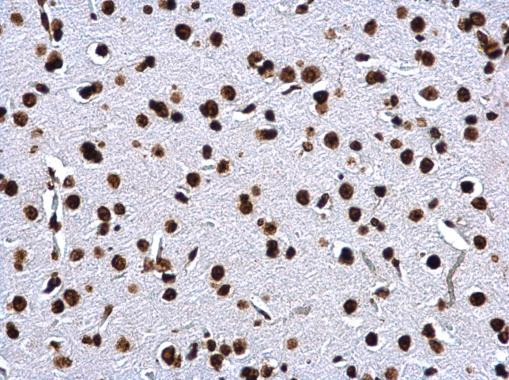 Histone H2A Antibody in Immunohistochemistry (Paraffin) (IHC (P))