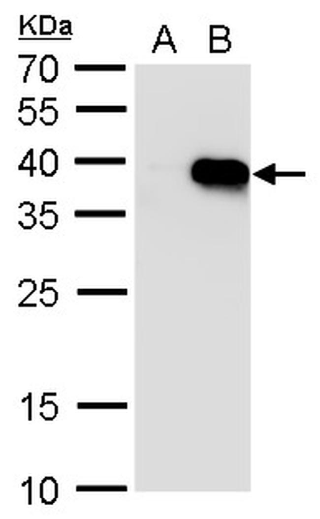 HOXA5 Antibody in Western Blot (WB)