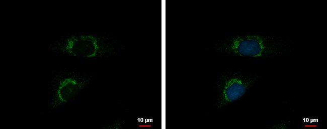 INTU Antibody in Immunocytochemistry (ICC/IF)