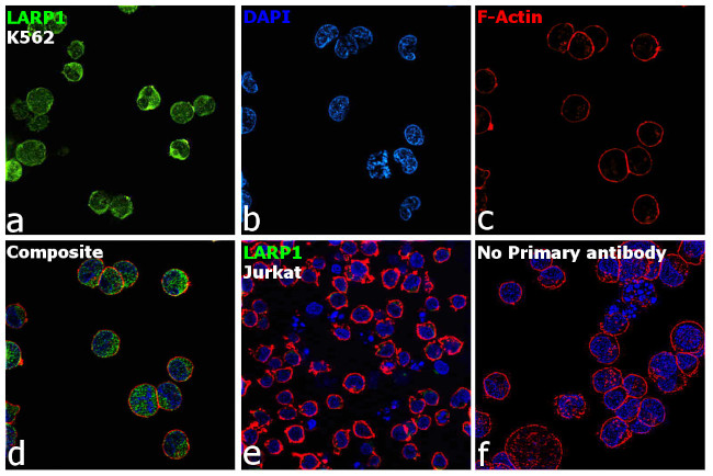 LARP1 Antibody in Immunocytochemistry (ICC/IF)