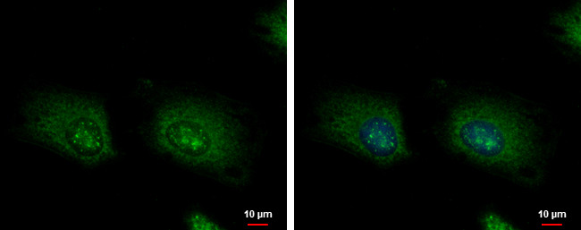 LARP1 Antibody in Immunocytochemistry (ICC/IF)