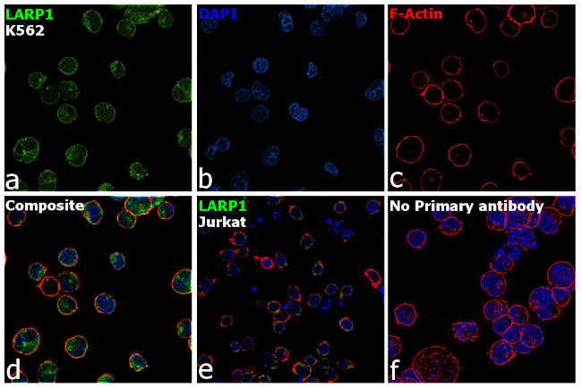 LARP1 Antibody in Immunocytochemistry (ICC/IF)