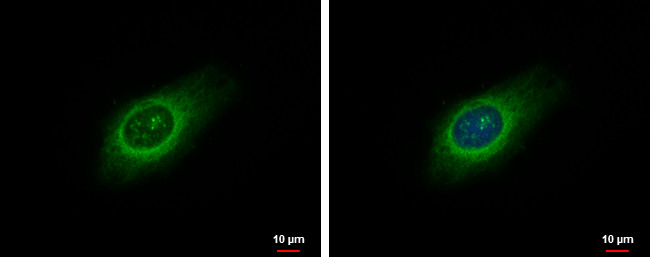 LARP1 Antibody in Immunocytochemistry (ICC/IF)