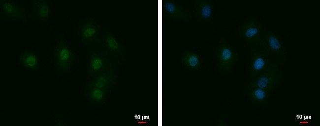 LCMT1 Antibody in Immunocytochemistry (ICC/IF)