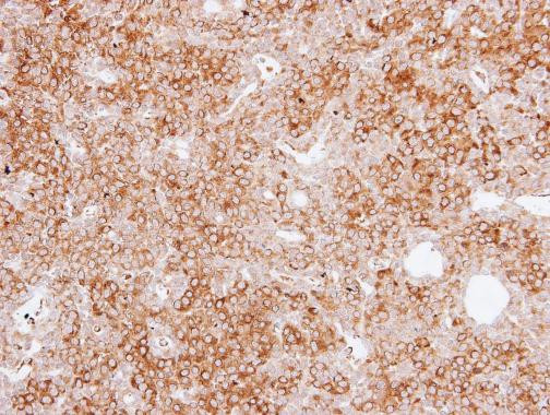 MAP4 Antibody in Immunohistochemistry (Paraffin) (IHC (P))