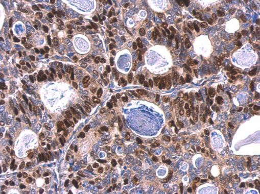 MCM6 Antibody in Immunohistochemistry (Paraffin) (IHC (P))