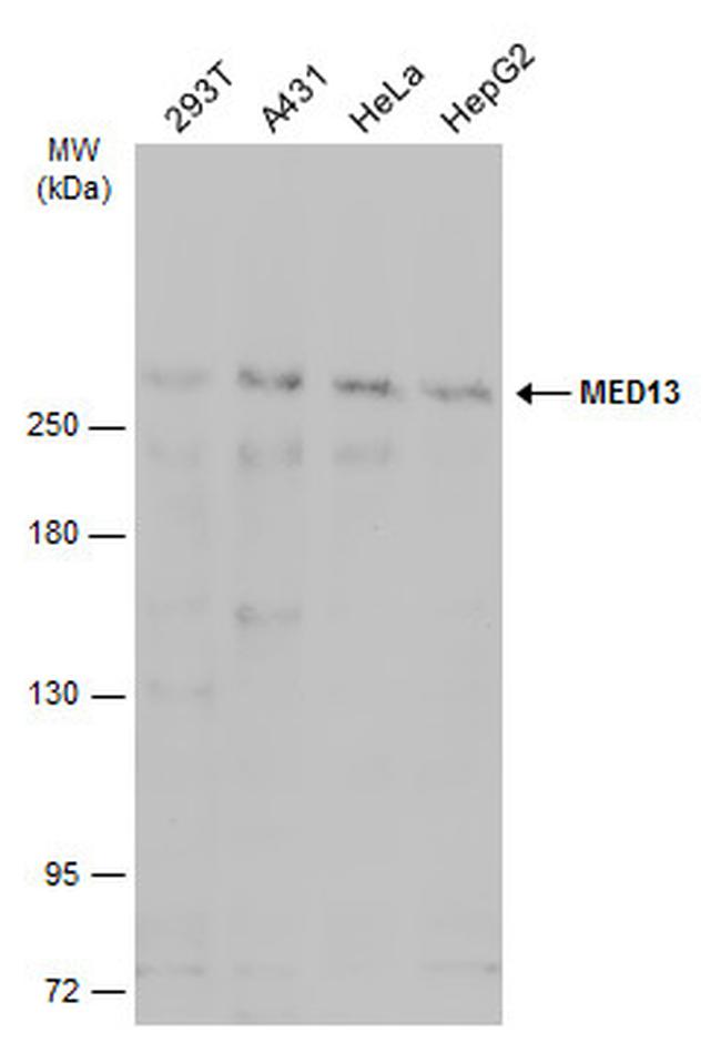 MED13 Antibody in Western Blot (WB)